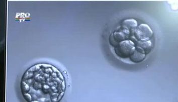 Nu puteti ramane insarcinata? Realizati un control al trompelor uterine!