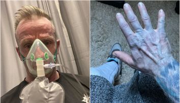 S-a trezit albastru din cap până în picioare și a fugit la spital. Când au descoperit cauza, medicii au început să râdă: 