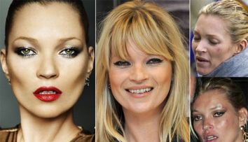 Kate Moss: declinul unei frumuseti emblematice. Cum au distrus-o tigarile, drogurile si petrecerile non-stop