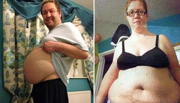 Au fost dependenti de fast food si uite cum au ajuns. Un accident stupid i-a motivat sa scape de kilogramele in plus: FOTO
