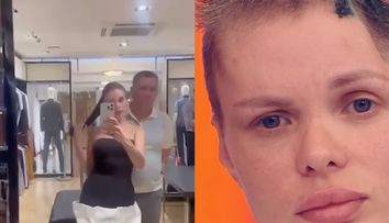 Au apărut imagini cu tânăra de 33 de ani bătută cu brutalitate de iubitul său. I-a fost îndepărtată o parte din craniu