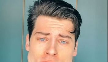 Luca Marchesi, modelul care în două luni și-a mărit maxilarul, fără intervenții estetice. Cum a reușit