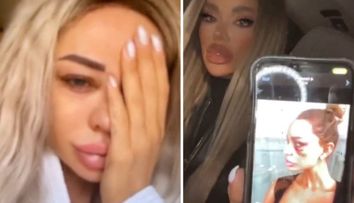 Bianca Drăgușanu, imagini șocante! A publicat poze după ce a fost bătută cu bestialitate în nenumărate rânduri