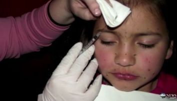 Mama care isi injecta fiica de 8 ani cu Botox, pedepsita! Protectia Copilului a intervenit