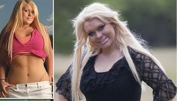 La numai 12 ani si-a facut liposuctie, iar pana la 17 si-a pus inel gastric si silicoane...ca sa arate ca papusa Barbie!  