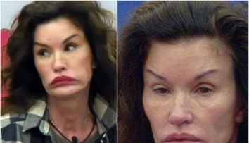 Primul supermodel al lumii a ajuns de nerecunoscut!  În tinerețe avea un chip perfect și corp de zeiță, dar operațiile estetice au mutilat-o! Prima intervenția și-a făcut-o când era iubita lui Sylvester Stallone