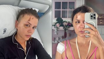 Emily Burghelea va fi operată, în urma accidentului în care a fost implicată. Fosta asistentă a fost nevoită să se radă în cap pentru intervenție: „Am lacrimi în ochi”
