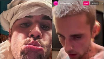 Justin Bieber, într-o stare alarmantă: Hailey Bieber cere disperată ajutor pentru soțul ei! 
