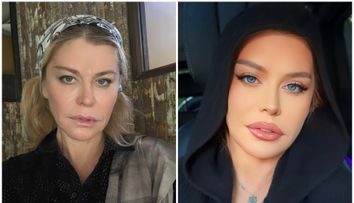 Loredana nu își mai ascunde chipul în spatele filtrelor de înfrumusețare. Vedeta a început să posteze mai multe imagini cu look-ul său real