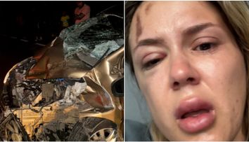 Emily Burghelea are nevoie de operații după tragicul accident de mașină! Vedeta este aproape desfigurată: „Alerg prin spitale!”