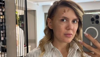 Noi detalii despre starea de sănătate a lui Emily Burghelea. „Ceva mă sperie și mă neliniștește profund”