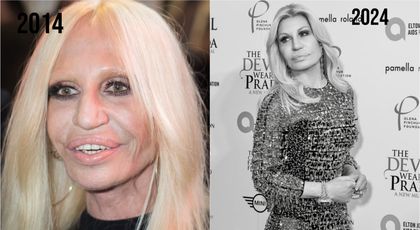 Donatella Versace nu renunță la operații estetice nici la 69 de ani. Fanii, siderați: “Ce și-a mai făcut la față?”