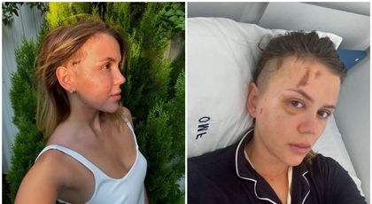 Emily Burghelea, schimbare radicală de look după accidentul grav din Mauritius: „Viața e prea scurtă ca să ne fie frică de schimbări”