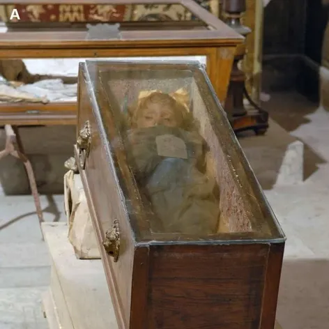 The mummy of Rosalia Lombardo .In the depths of an obscure Sicilian catacomb, there lies a young girl in an open casket. Her name is Rosalia Lombardo and she died at the tragically young age of two due t (2)