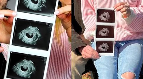 Influencerița și soțul ei au decis să întrerupă sarcina după ce au aflat că fătul are sindromul Down. Sunt amenințați cu moartea și dorm cu un pistol lângă pat: „Nu mi-am dat seama cât de greu este pentru copil”
