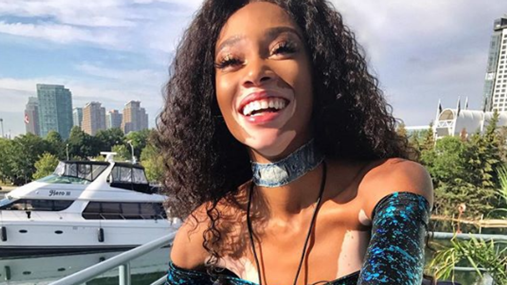 A pozat NUD, iar acum uimeste din nou. Cum s-a lasat pozata Winnie Harlow. Se dezbraca de secrete