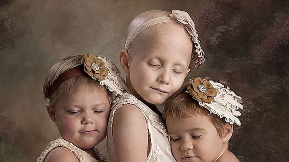Sufereau de cancer cand au fost fotografiate asa, iar imaginea a ajuns viral. Acum sarbatoresc vindecarea