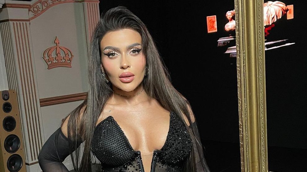 Oana Radu și-a făcut o nouă operație estetică după ce a slăbit peste 100 de kilograme