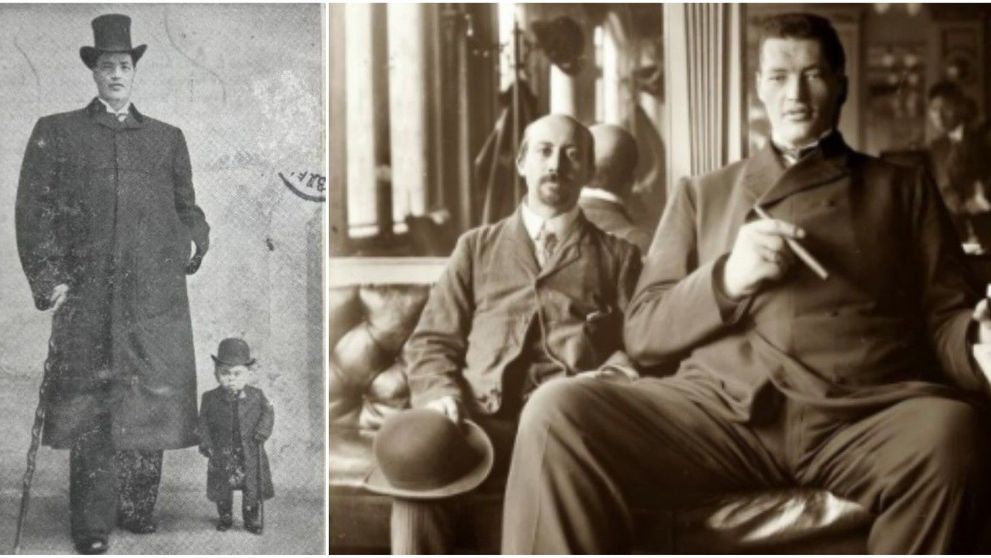 S-a nascut pitic, dar a decedat un urias. Cazul incredibil al barbatului care a suferit si de nanism si de gigantism