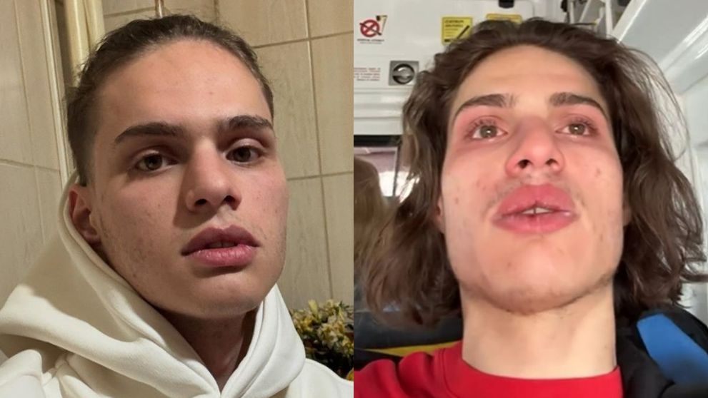Apar noi detalii tulburătoare despre moartea lui Rareș Ion. Maru s-a rugat o oră de el să consume droguri: „I-a spus că o să fie bun, apoi a pornit live-ul. Voia să ia 