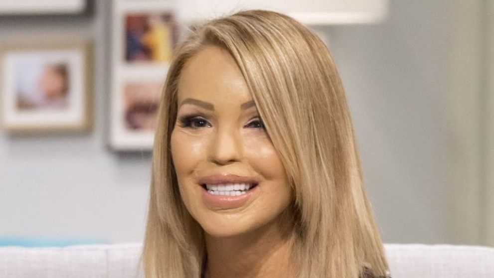 Aparitie superba a femeii pe care fostul iubit a desfigurat-o cu acid sulfuric. Cum arata acum Katie Piper