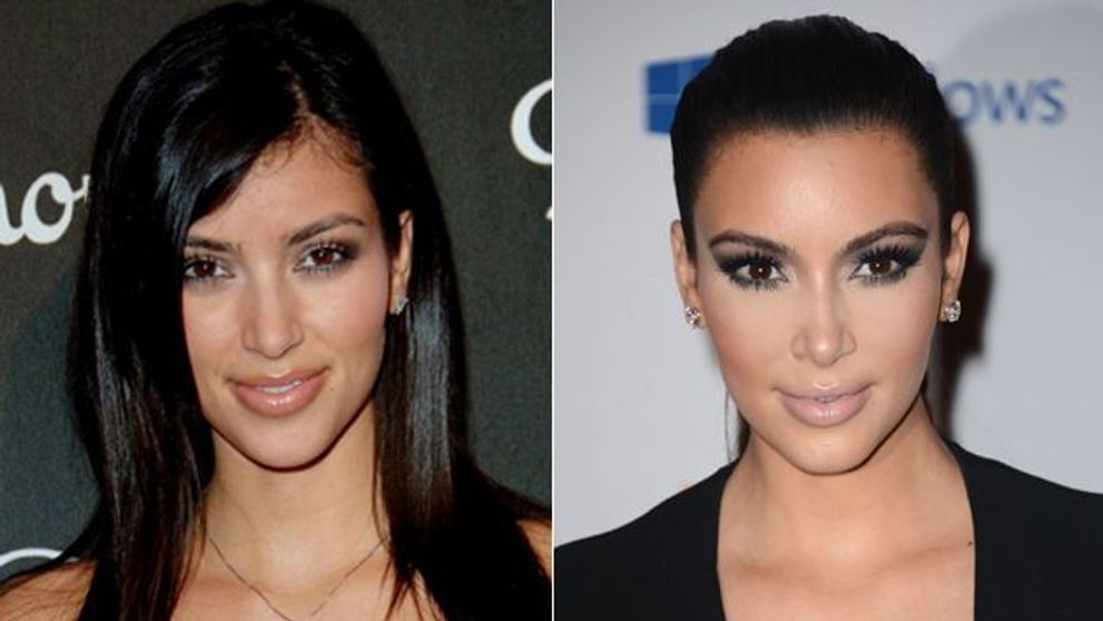 Chipul perfect al lui Kim Kardashian, rezultatul operatiilor estetice de mii de dolari. Imaginile de care spera sa nu-si mai aminteasca nimeni
