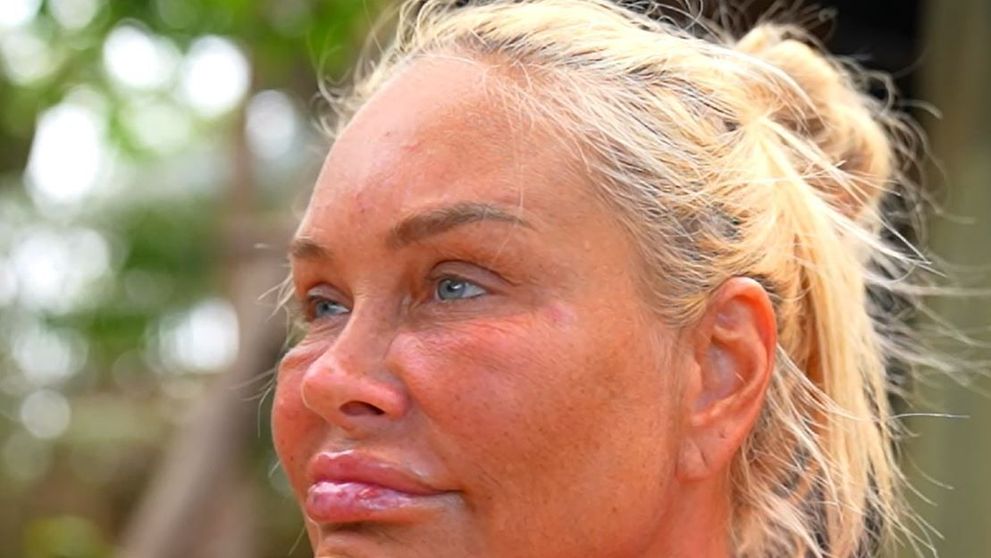 Ce s-a întâmplat cu fața Vicăi Blochina la Survivor România: „Aveam bube peste tot”