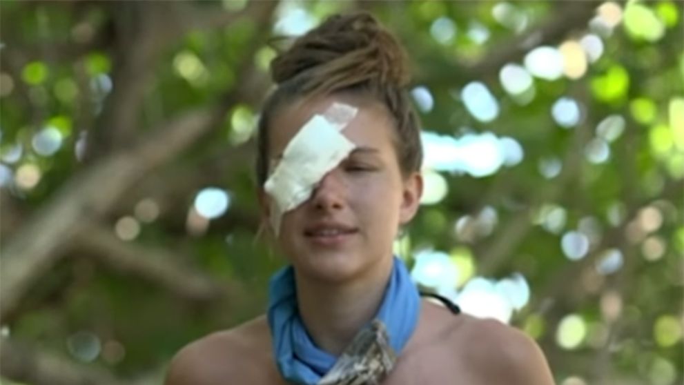 De ce a apărut Alexandra Ciomag cu ochiul bandajat la Survivor All Stars. Fanii, de-a dreptul îngrijorați pentru Războinică