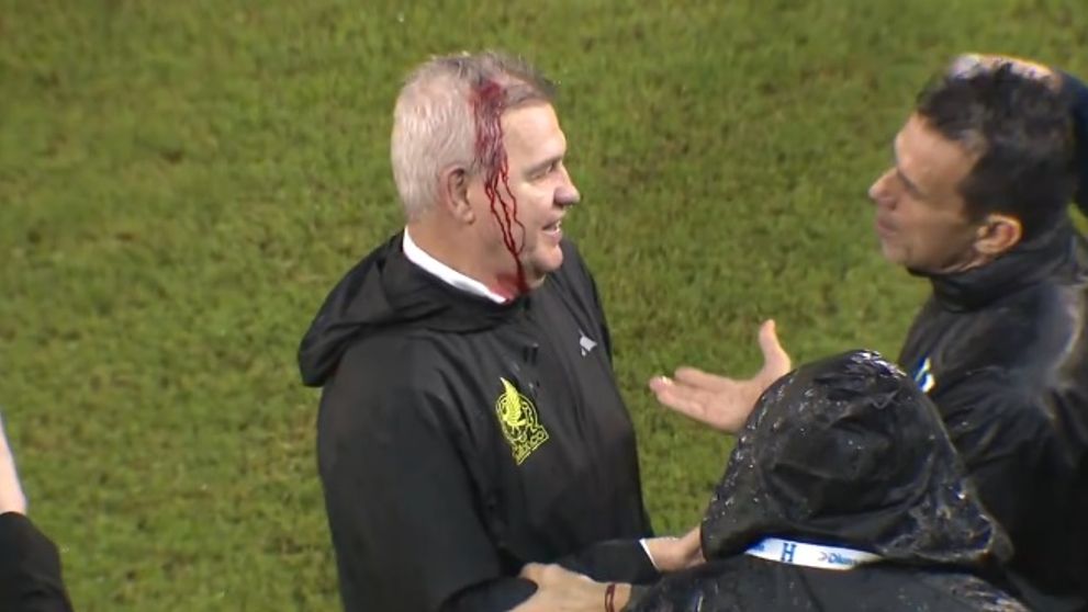 Un antrenor a părăsit terenul de fotbal plin de sânge după ce a fost lovit în cap de către cei din tribune - VIDEO