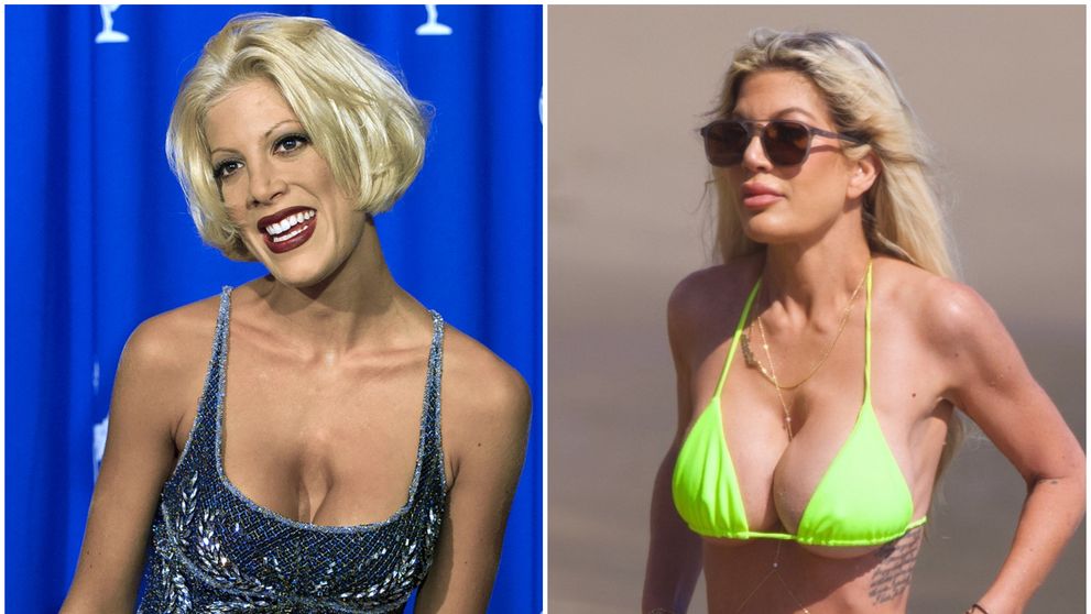 Motivul bizar pentru care Tori Spelling are o gaură uriașă între sâni: 