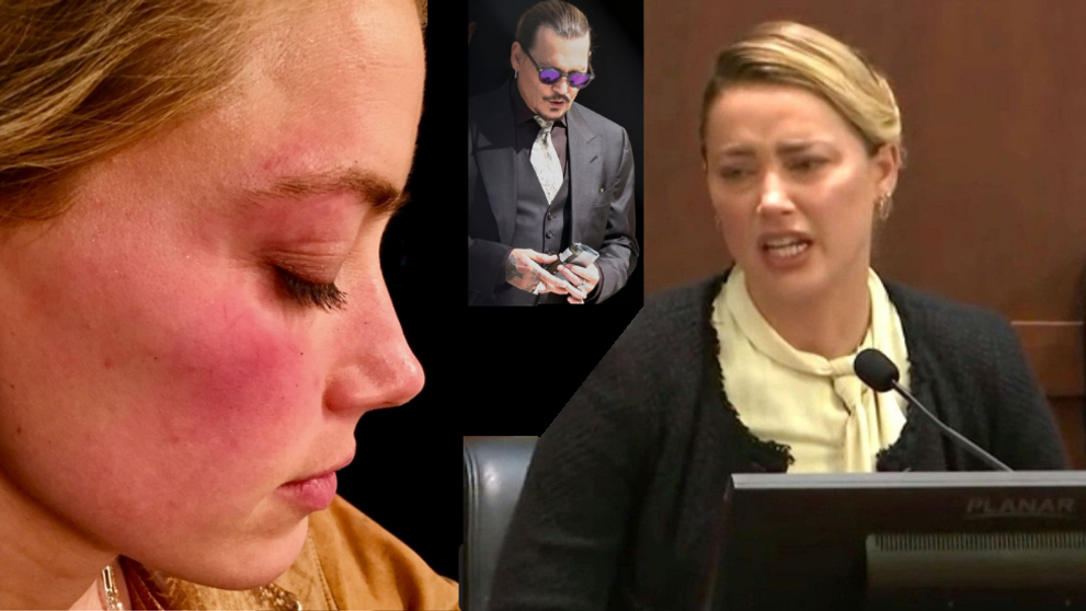Amber Heard a arătat judecătorului vânătăile pe care i le-ar fi făcut Johnny Depp în trecut