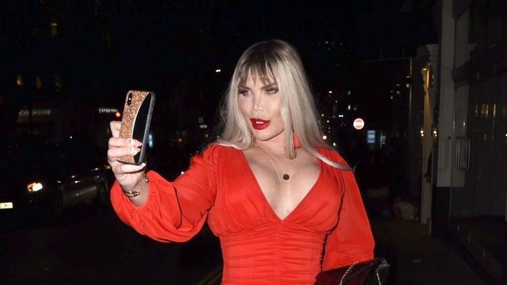 Fotografii șocante cu Rodrigo Alves după ultima intervenție estetică. Cum arată după operația de feminizare facială
