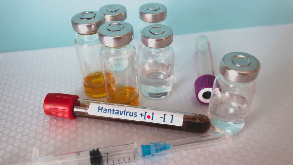 Ce simptome provoacă hantavirus, virusul potențial mortal care s-a răspândit acum pe o croazieră în Atlantic și care a ucis-o pe soția lui Gene Hackman