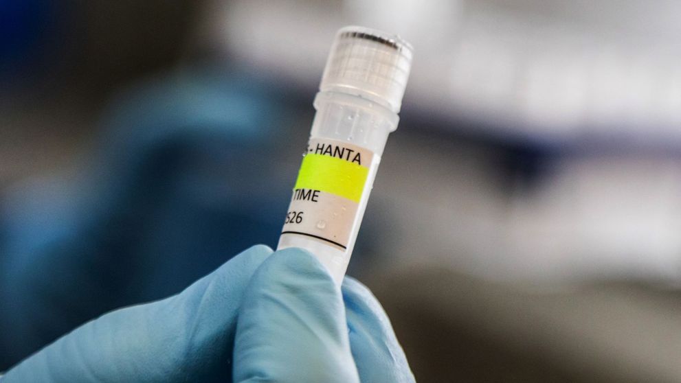 Posibil caz de hantavirus în Spania! O femeie a fost izolată în Alicante, după ce a avut contact cu un pacient infectat