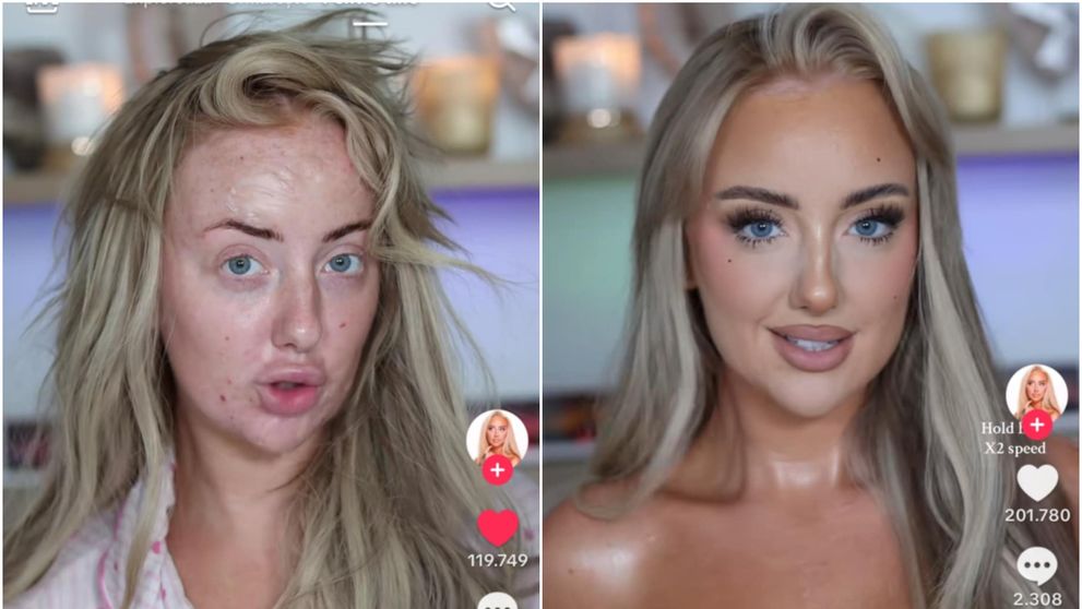 Transformare șocantă: de la acnee și imperfecțiuni la diva absolută.  
