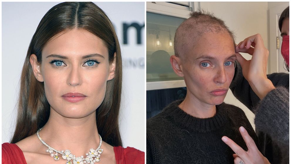 Bianca Balti, fost îngeraș Victoria’s Secret, a publicat o serie de imagini cutremurătoare de când a început lupta ei cu cancerul. „A fost greu și încă nu s-a terminat”