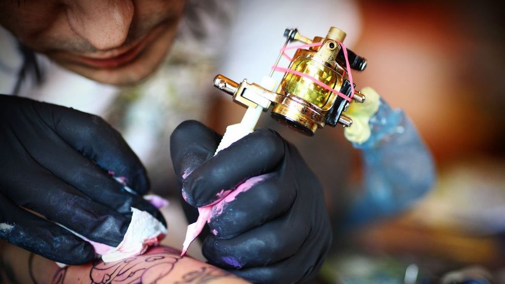 Cum arata pielea dupa eliminarea unui tatuaj cu ajutorul laserului. Imaginile sunt virale