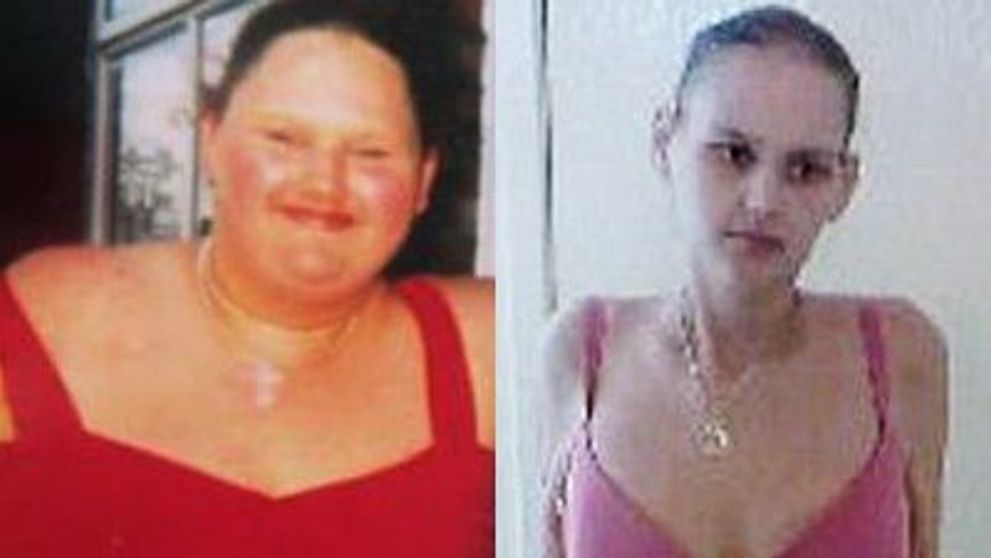 De la supraponderala la anorexica! Povestea unei adolescente in pericol sa isi piarda viata! FOTO