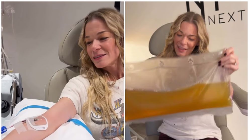 LeAnn Rimes, tratament extrem de „curățare a sângelui” de 45.000 de dolari, după ce i-au căzut dinții pe scenă