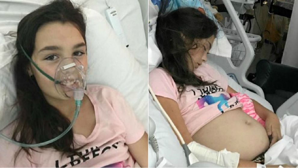 Medicii au crezut ca este insarcinata, insa ce au descoperit apoi i-a socat