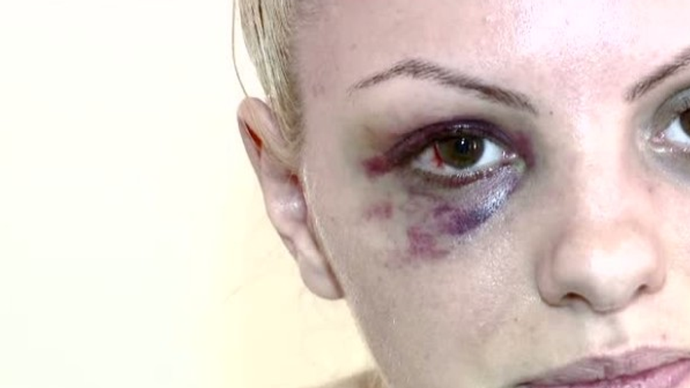 Alexandra Stan, supusa unei investigatii la tomograf. Cantareata se plange inca de dureri mari de cap