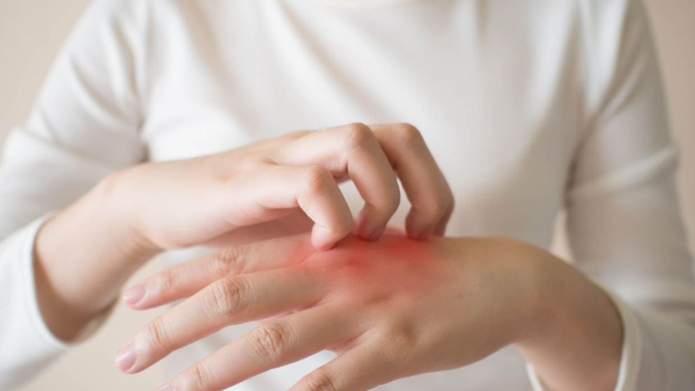 (P) Mâncărimea de piele reală vs. mâncărimile psihogene - Află care sunt diferențele
