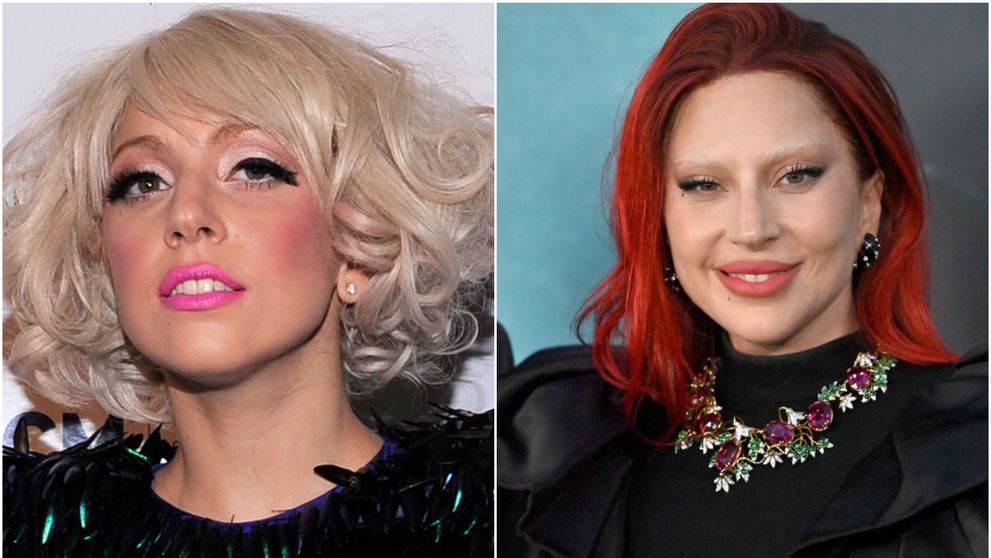 Lady Gaga, cu fizionomia schimbată radical. Vedeta arată diferit, iar chirurgii esteticieni și-au dat seama ce operații și-a făcut
