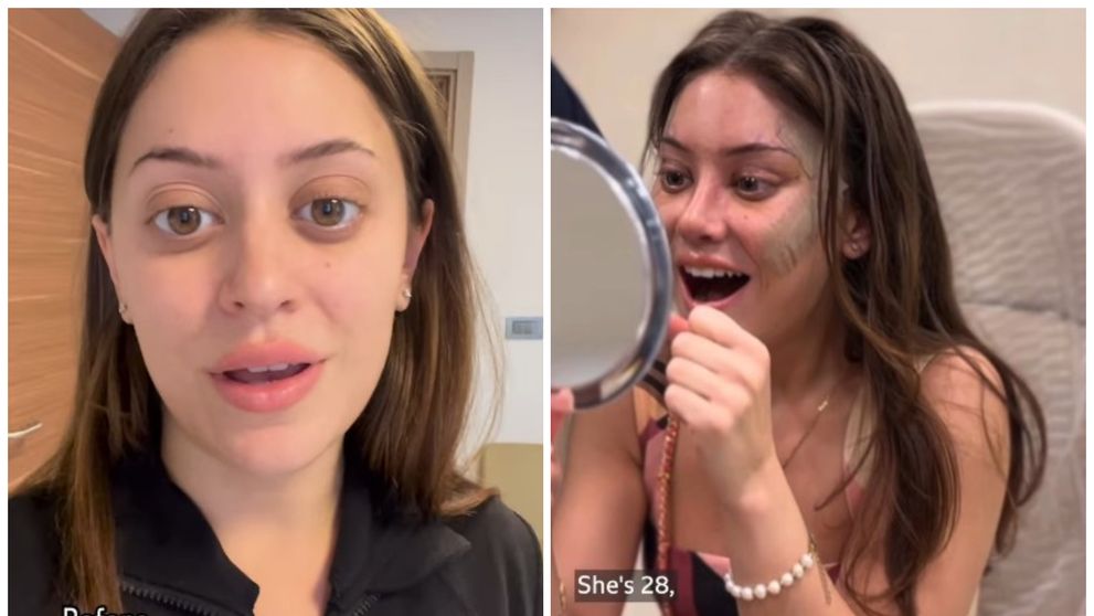 De ce o tânără de 28 de ani a recurs la lifting facial chirurgical, chiar dacă mulți i-au spus că este prea devreme