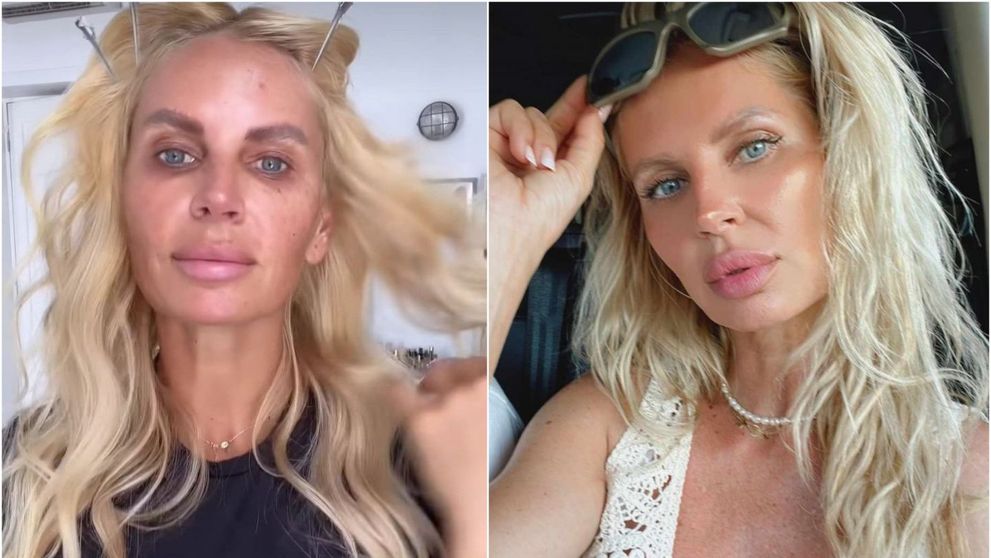 Andreea Bănică și-a rezolvat problemele cu tenul pătat. Vedeta și-a afișat look-ul impecabil în Sardinia