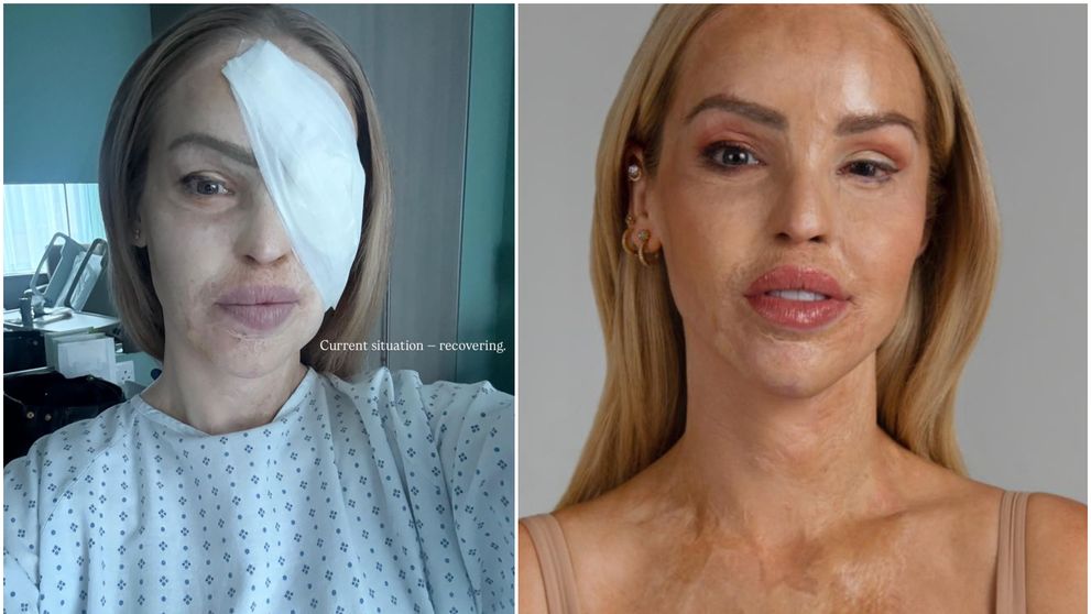 Era una dintre cele mai frumoase prezentatoare TV, însă a ajuns de nerecunoscut după ce iubitul ei a stropit-o cu acid sulfuric pe față! Cum arată astăzi, la aproape 20 de ani de la accidentul tragic