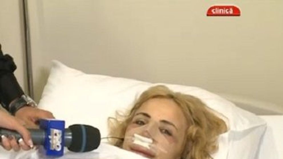 O blonda celebra din Romania, aproape de nerecunoscut dupa ultima operatie estetica: VIDEO
