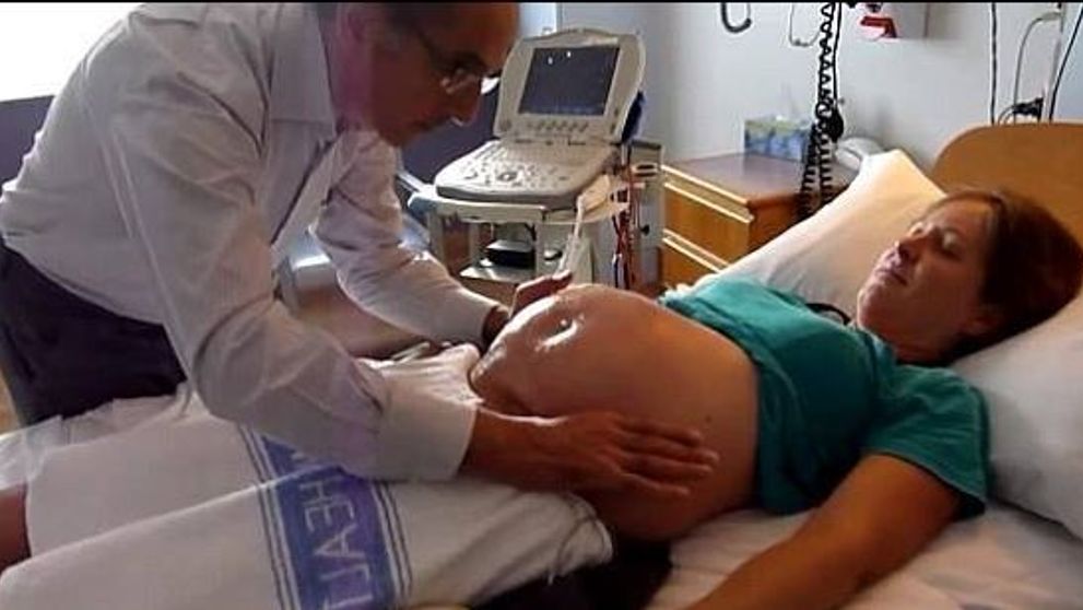 Momentul incredibil in care un bebelus aflat in burta mamei sale este intors de un doctor doar cu mainile - VIDEO
