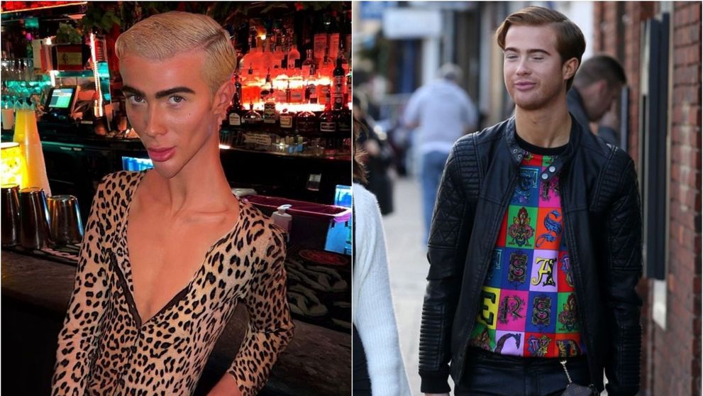 S-a făcut remarcat la tv, dar acum șochează cu aspectul său. Starul de reality show care a ajuns la 47 kg