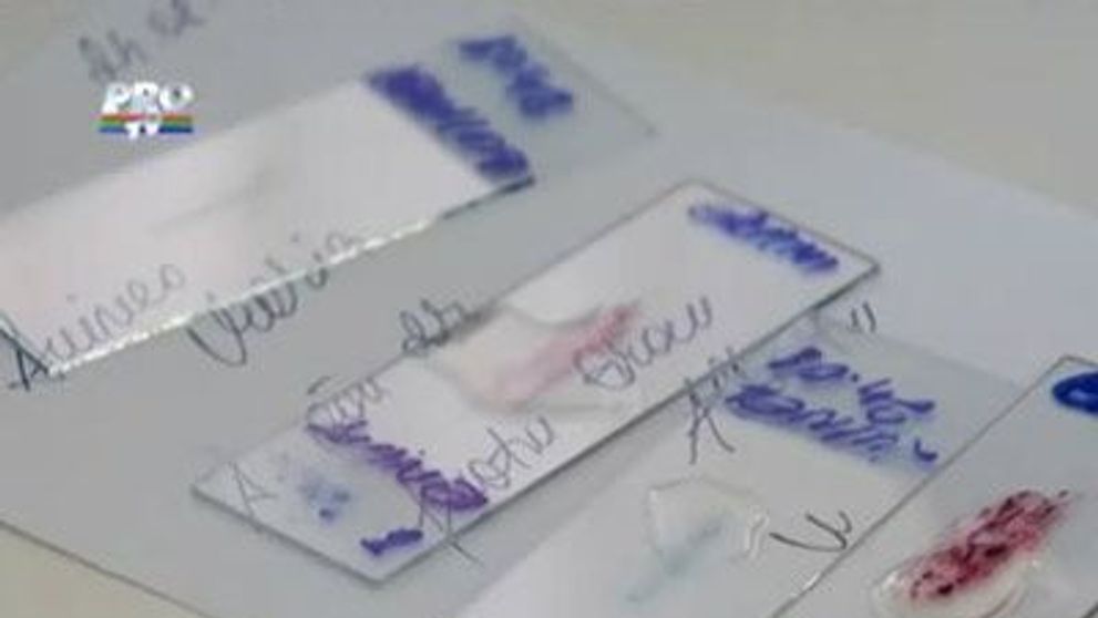 Nu luati antibiotice sau aspirina daca aveti gripa! Mergeti cat mai repede la medic